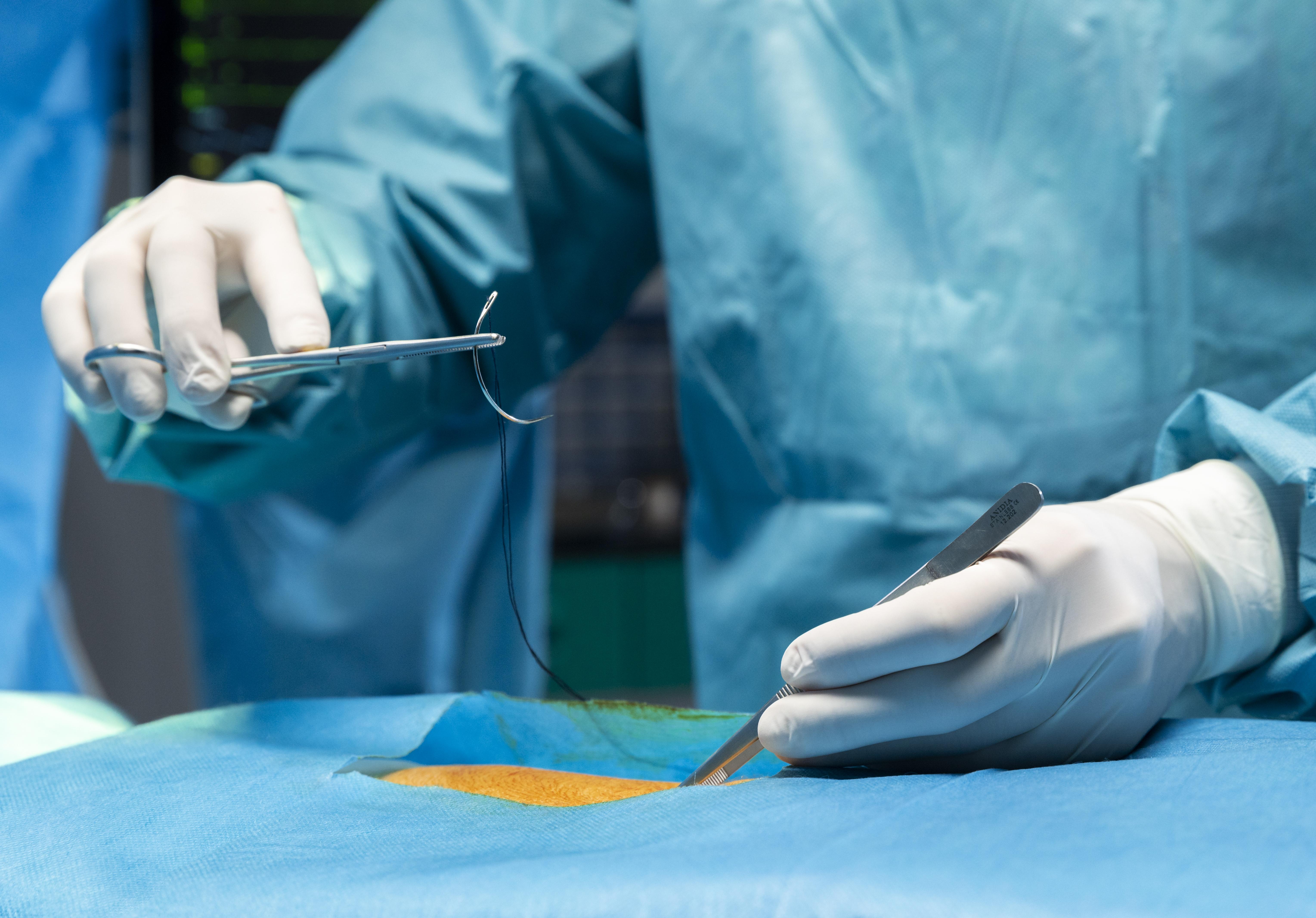 Guide to Minimally Invasive Surgery at Nims Micro Hospitals